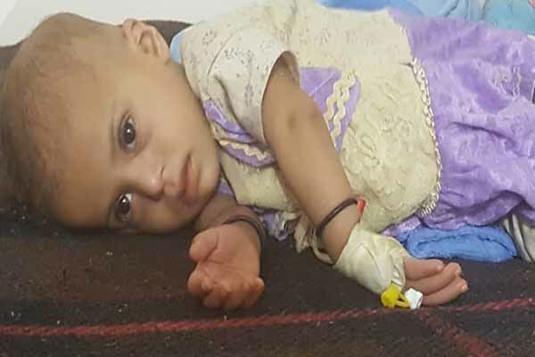۸۰ درصد یمنیها به کمک های فوری غذایی نیاز دارند ۸۰ درصد یمنیها به کمک های فوری غذایی نیاز دارند